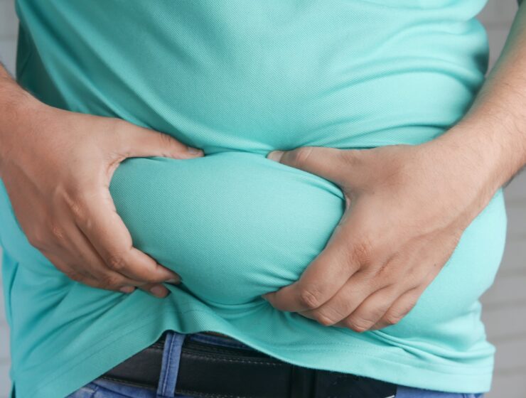 Visceralno masno tkivo