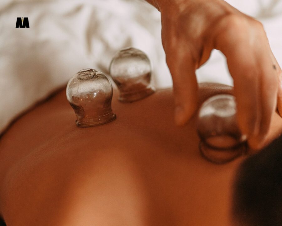 Cupping